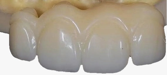 Anatomic crown